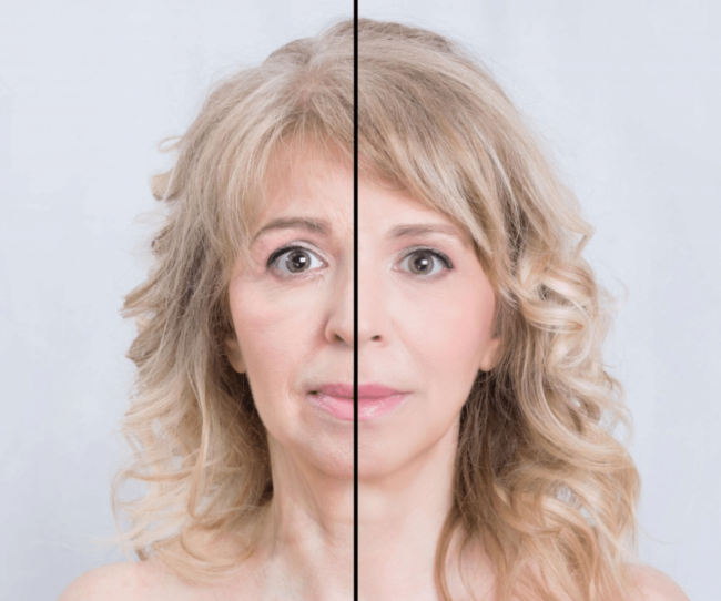 Gençlik Aşısı H-100 Gençlik Aşısı H-100