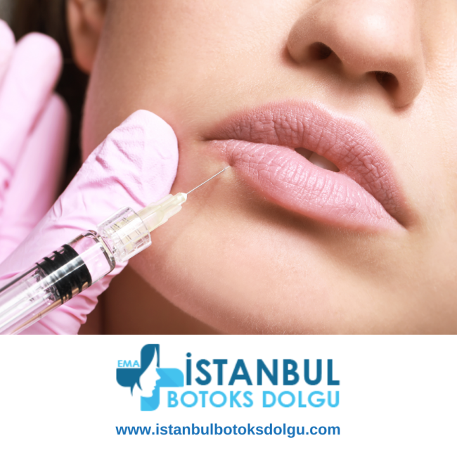 Fransız Dudak Dolgusu Fransız Dudak Dolgusu