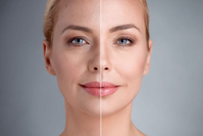 İstanbulda En İyi Göz Altı Işık Dolgusu Yapan Yerler İstanbulda En İyi Göz Altı Işık Dolgusu Yapan Yerler