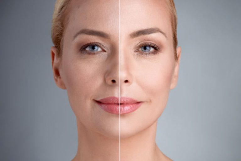 İstanbulda En İyi Göz Altı Işık Dolgusu Yapan Yerler